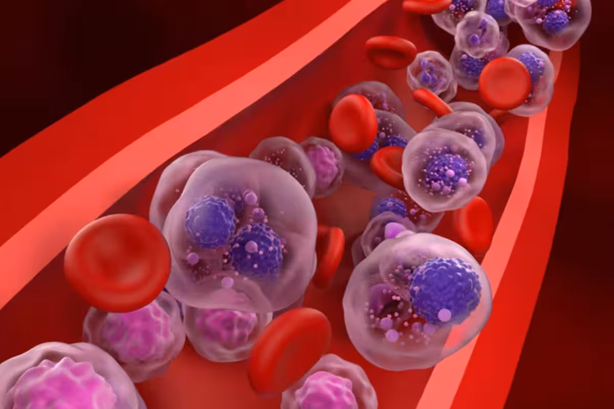 Un cóctel de drogas da vida y esperanza a los pacientes con una agresiva forma de cáncer